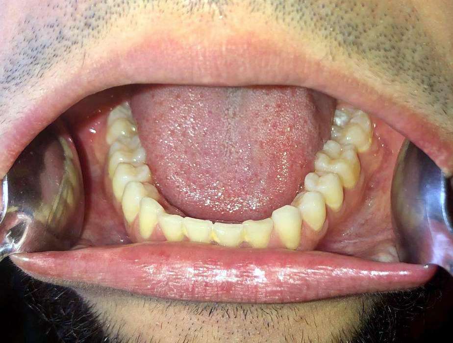 Remote Orthodontic Consultations Dublin Orthodontics